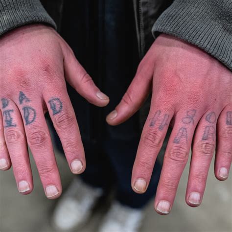 A new drug could help frostbite victims avoid its ravages .